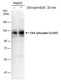 Invitrogen Phospho-FAK (Tyr397) Polyclonal Antibody 100 &mu;L; Unconjugated:Antibodies,