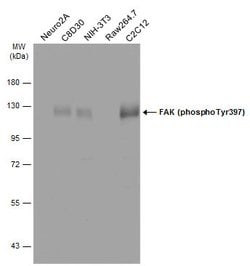 Invitrogen Phospho-FAK (Tyr397) Polyclonal Antibody 100 &mu;L; Unconjugated:Antibodies,