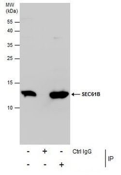 Invitrogen SEC61B Polyclonal Antibody 100 &mu;L; Unconjugated:Antibodies,