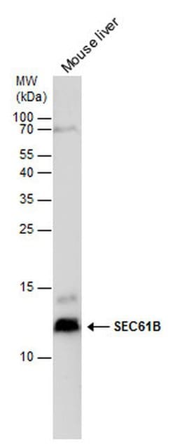 Invitrogen SEC61B Polyclonal Antibody 100 &mu;L; Unconjugated:Antibodies,