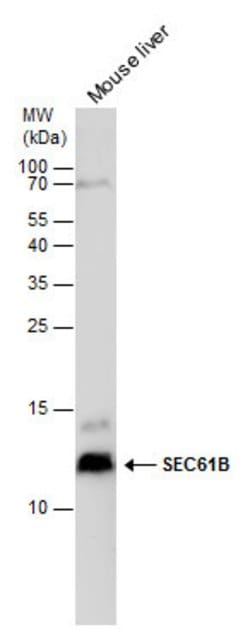Invitrogen SEC61B Polyclonal Antibody 100 &mu;L; Unconjugated:Antibodies,