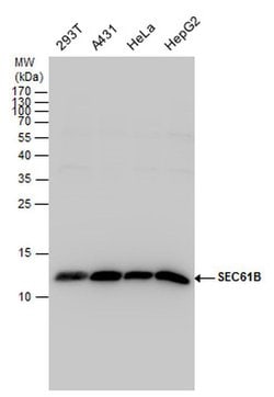 Invitrogen SEC61B Polyclonal Antibody 100 &mu;L; Unconjugated:Antibodies,