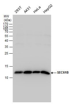 Invitrogen SEC61B Polyclonal Antibody 100 &mu;L; Unconjugated:Antibodies,