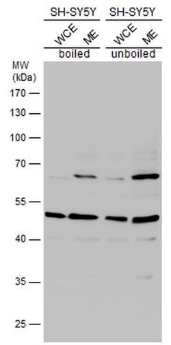 HTR2B Polyclonal Antibody, Invitrogen™