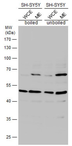 HTR2B Polyclonal Antibody, Invitrogen&trade;