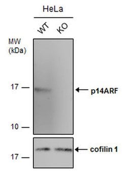 Invitrogen p14ARF Polyclonal Antibody 100 &mu;L; Unconjugated:Antibodies,
