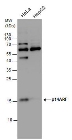 Invitrogen p14ARF Polyclonal Antibody 100 &mu;L; Unconjugated:Antibodies,