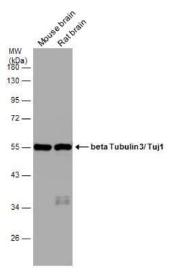 Invitrogen beta-3 Tubulin Polyclonal Antibody 100 &mu;L; Unconjugated:Antibodies,