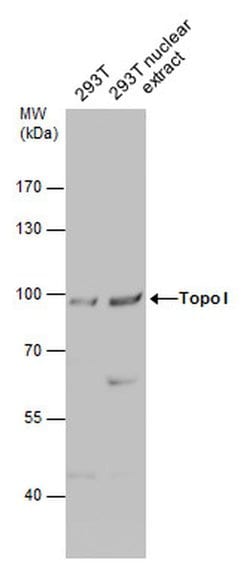 Invitrogen TOP1 Polyclonal Antibody 100 &mu;L; Unconjugated:Antibodies,