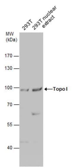 Invitrogen TOP1 Polyclonal Antibody 100 &mu;L; Unconjugated:Antibodies,