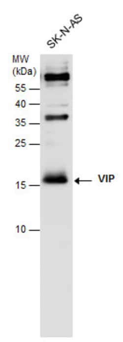 Invitrogen VIP Polyclonal Antibody 100 &mu;L; Unconjugated:Antibodies,