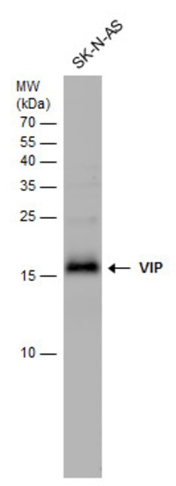Invitrogen VIP Polyclonal Antibody 100 &mu;L; Unconjugated:Antibodies,
