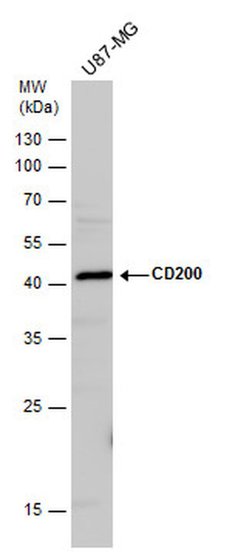Invitrogen CD200 Polyclonal Antibody 100 &mu;L; Unconjugated:Antibodies,