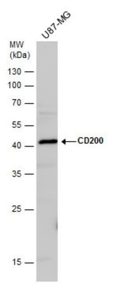 Invitrogen CD200 Polyclonal Antibody 100 &mu;L; Unconjugated:Antibodies,