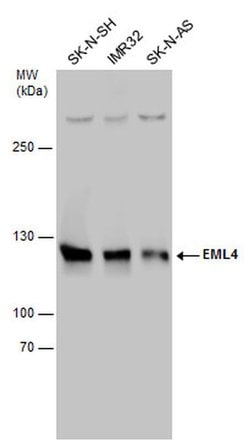 EML4 Polyclonal Antibody:Antibodies, Polyclonal