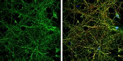Invitrogen NMDAR2B Polyclonal Antibody 100 &mu;L; Unconjugated:Antibodies,