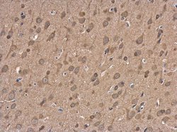Invitrogen NMDAR2B Polyclonal Antibody 100 &mu;L; Unconjugated:Antibodies,