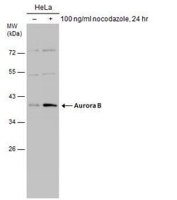 Invitrogen Aurora B Polyclonal Antibody 100 &mu;L; Unconjugated:Antibodies,