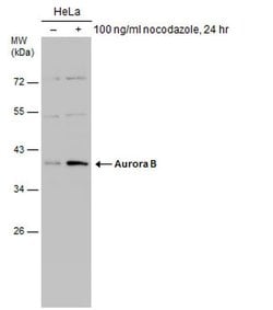 Invitrogen Aurora B Polyclonal Antibody 100 &mu;L; Unconjugated:Antibodies,