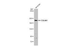 Invitrogen COL4A1 Polyclonal Antibody 100 &mu;L | Buy Online | Invitrogen&trade; | Fisher Scientific