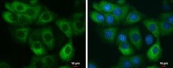 Invitrogen AGR2 Polyclonal Antibody 100 &mu;L; Unconjugated:Antibodies,