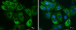 Invitrogen AGR2 Polyclonal Antibody 100 &mu;L; Unconjugated:Antibodies,