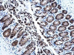 Invitrogen AGR2 Polyclonal Antibody 100 &mu;L; Unconjugated:Antibodies,