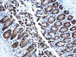 Invitrogen AGR2 Polyclonal Antibody 100 &mu;L; Unconjugated:Antibodies,