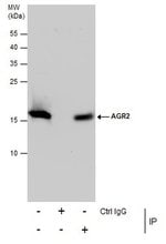AGR2 Polyclonal Antibody, Invitrogen™