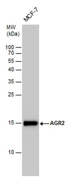 Invitrogen AGR2 Polyclonal Antibody 100 &mu;L; Unconjugated:Antibodies,