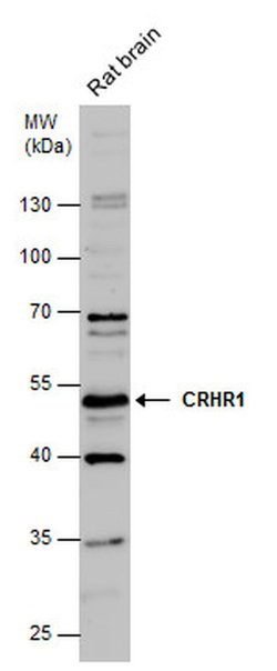 CRHR1 Polyclonal Antibody, Invitrogen 100 &mu;L; Unconjugated:Antibodies,