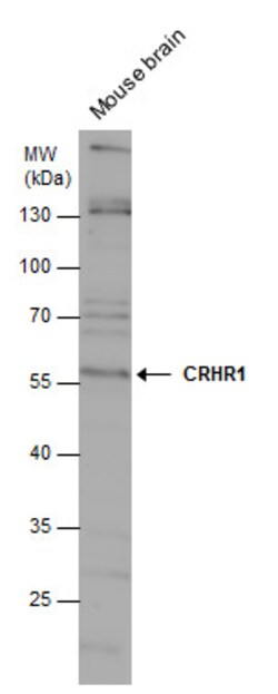 CRHR1 Polyclonal Antibody, Invitrogen 100 &mu;L; Unconjugated:Antibodies,