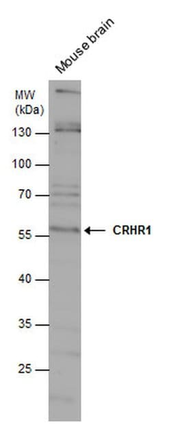 CRHR1 Polyclonal Antibody, Invitrogen 100 &mu;L; Unconjugated:Antibodies,