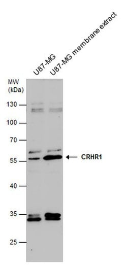 CRHR1 Polyclonal Antibody, Invitrogen 100 &mu;L; Unconjugated:Antibodies,