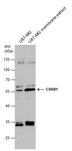 CRHR1 Polyclonal Antibody, Invitrogen 100 &mu;L; Unconjugated:Antibodies,