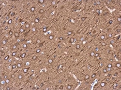 beta-3 Tubulin Polyclonal Antibody, Invitrogen 100 &mu;L; Unconjugated:Antibodies,