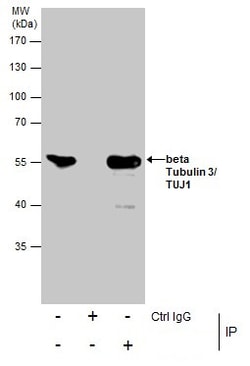 Invitrogen beta-3 Tubulin Polyclonal Antibody 100 &mu;L; Unconjugated:Antikroppar