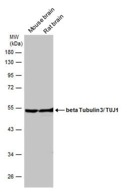 beta-3 Tubulin Polyclonal Antibody, Invitrogen&trade; 100 &mu;L; Unconjugated 