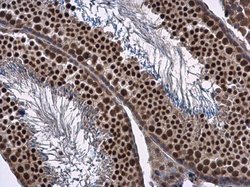 Invitrogen FOXO1 Polyclonal Antibody 100 &mu;L; Unconjugated:Antibodies,