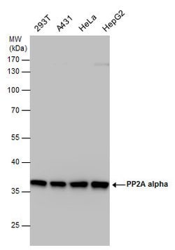 Invitrogen PP2A alpha Polyclonal Antibody 100 &mu;L | Buy Online | Invitrogen&trade; | Fisher Scientific