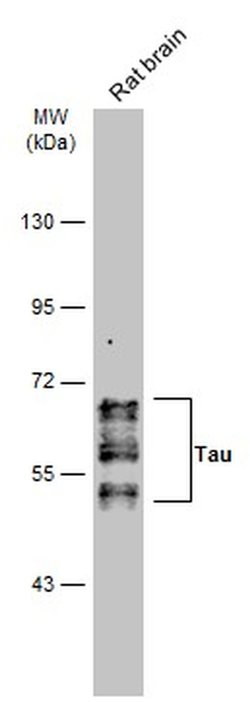 Invitrogen Phospho-Tau (Ser262) Polyclonal Antibody 100 &mu;L; Unconjugated:Antibodies,