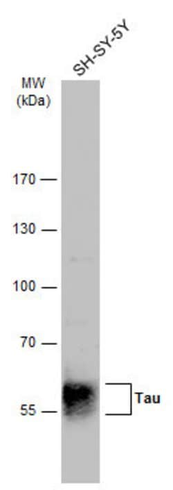 Invitrogen Phospho-Tau (Ser262) Polyclonal Antibody 100 &mu;L; Unconjugated:Antibodies,
