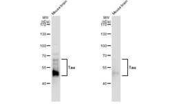 Invitrogen Phospho-Tau (Ser262) Polyclonal Antibody 100 &mu;L | Buy Online | Invitrogen&trade; | Fisher Scientific