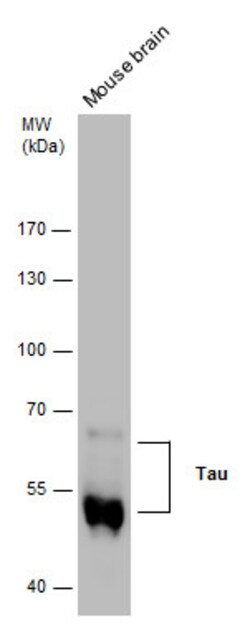 Invitrogen Phospho-Tau (Ser262) Polyclonal Antibody 100 &mu;L; Unconjugated:Antibodies,