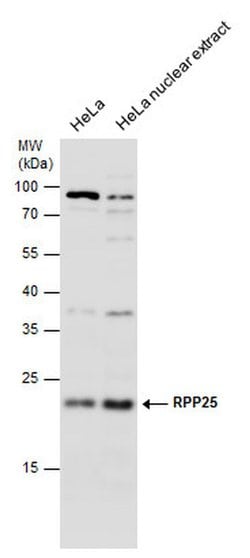Invitrogen RPP25 Polyclonal Antibody 100 &mu;L; Unconjugated:Antibodies,