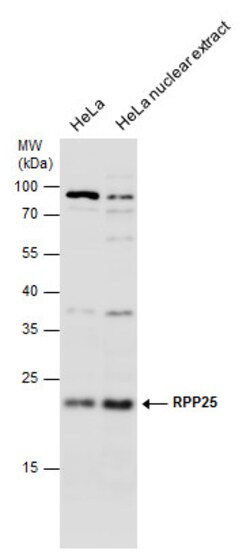 Invitrogen RPP25 Polyclonal Antibody 100 &mu;L; Unconjugated:Antibodies,
