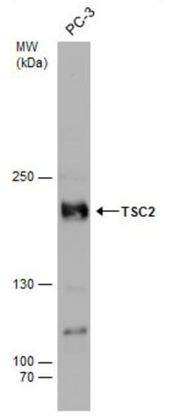 Invitrogen Phospho-TSC2 (Ser939) Polyclonal Antibody 100 &mu;L | Buy Online | Invitrogen&trade; | Fisher Scientific