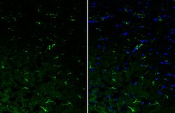 Invitrogen IL-10 Polyclonal Antibody 100 &mu;L; Unconjugated:Antibodies,