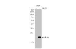 Invitrogen IL-10 Polyclonal Antibody 100 &mu;L; Unconjugated:Antibodies,