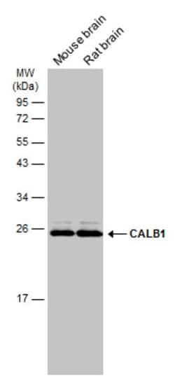 Invitrogen Calbindin D28K Polyclonal Antibody 100 &mu;L; Unconjugated:Antibodies,